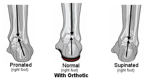 Orthotic Diagram