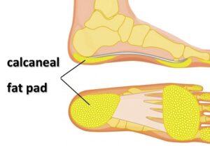 anatomical drawing of calcaneal fat pad