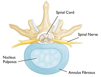 anatomy of lumbar spine disc, annulus, spinal cord, nerve