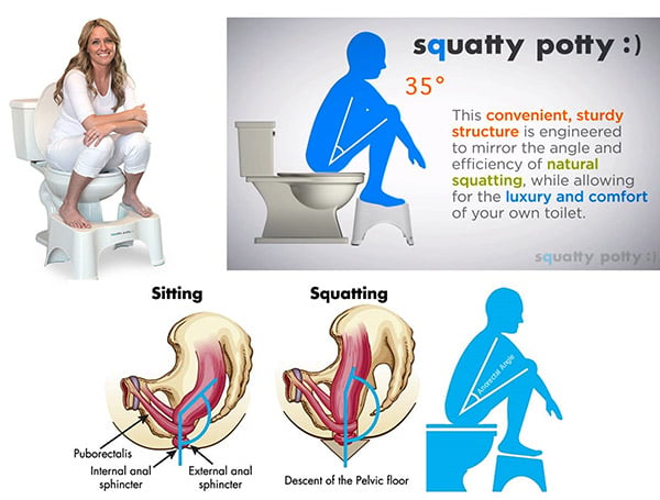 What can the Squatty Potty tell us about ourselves? -   - Virtual Physical Therapy For Sciatica Relief