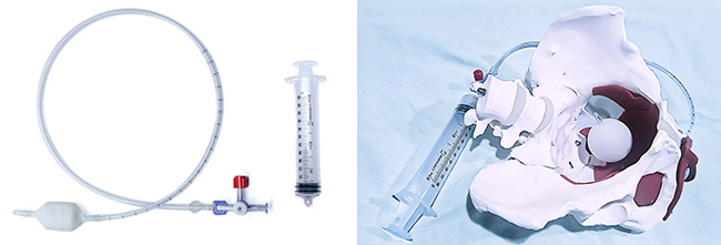 a balloon-catheter-for-rehabilitation-physiotherapy